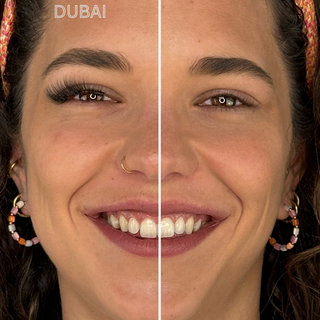 Vergleichsbild eines Gesichts: linke Seite mit dem Dubai-Magnetwimpern-Stil für einen dichten Wimpern-Look, ähnlich zu Wimpernextensions, rechte Seite ohne Magnetwimpern.