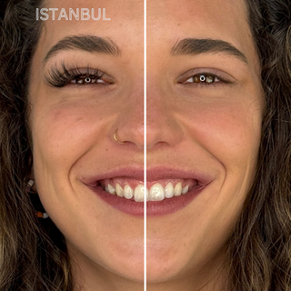 Vergleichsbild eines Gesichts: linke Seite mit dem Istanbul-Magnetwimpern-Stil für voluminöse lange Wimpern, rechte Seite ohne Magnetwimpern.